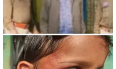 दूसरी कक्षा के बच्चे के साथ क्रूरतापूर्वक मारपीट करने वाला शिक्षक गिरफ्तार कर भेजा गया जेल  नशे की हालत में स्कूल के शिक्षक ने मात्र गिनती नहीं सुनाने पर बच्चे को कई थप्पड़ मार दिए थे